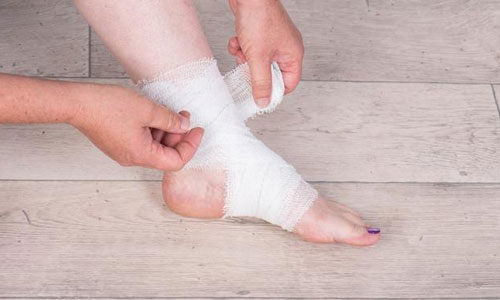 脚踝扭伤应该如何进行恢复好呢？