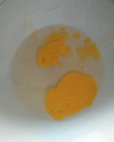 这种鸡蛋吃了后果太吓人了