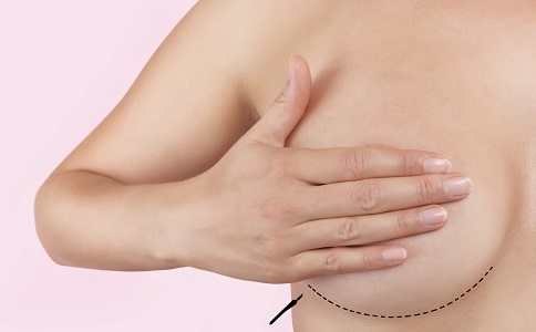 如何告别副乳 减去副乳的方法有哪些 该如何减去副乳