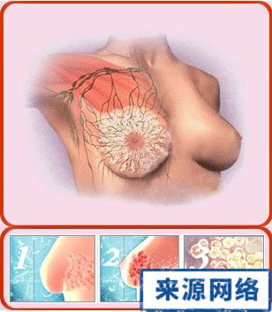 女性乳头 乳头变黑 乳头凹陷