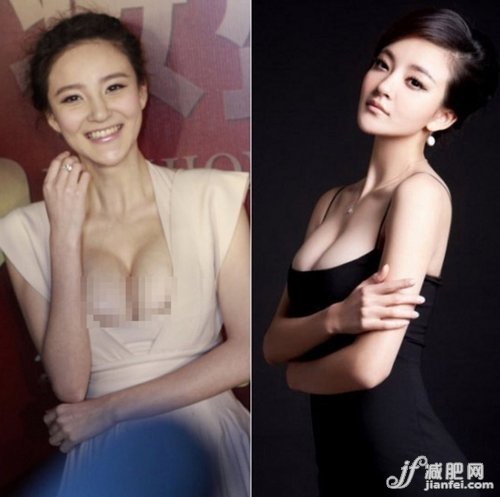 杨幂刘雨欣 G奶女星真假胸器