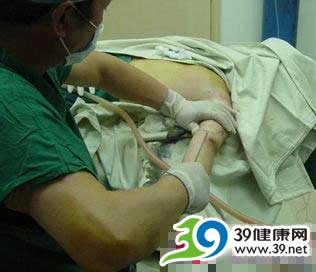 一个mm的抽脂减肥真实全程(图)