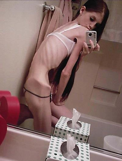 减肥比赛