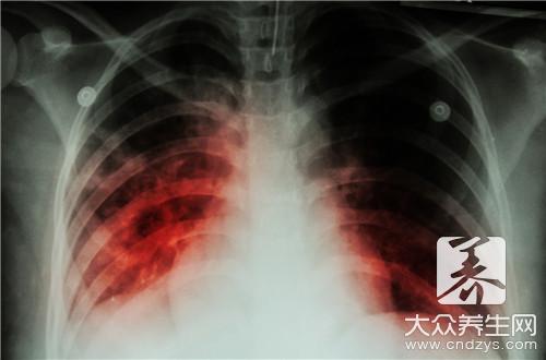 结核药物有什么副作用？