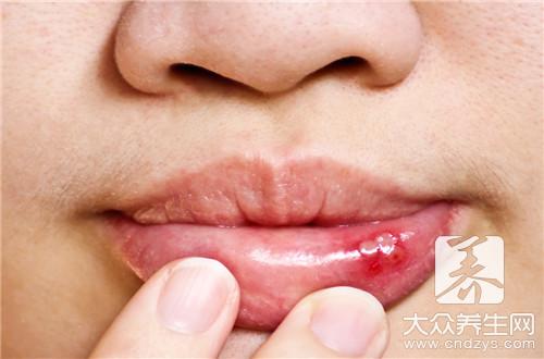 治疗口腔溃疡，6种水果被誉为“特效药”！(1)