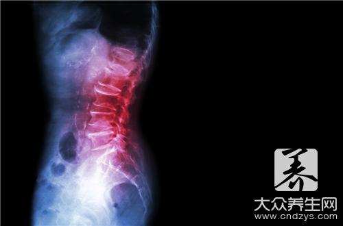 强直性脊柱炎吃吃什么东西比较好？