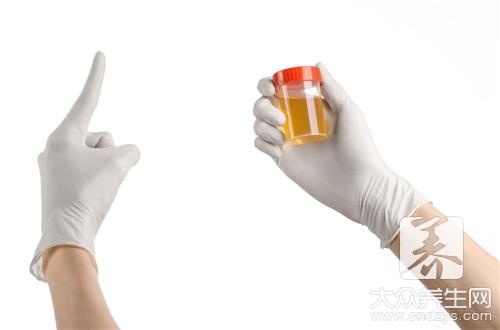 尿酸高可以吃鸡蛋的吗？