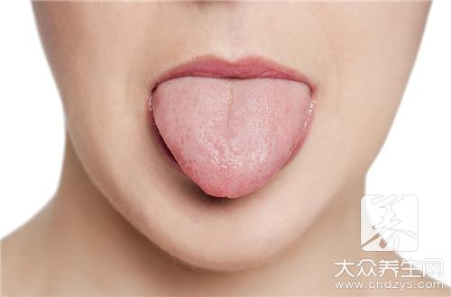 没有舌苔是怎么回事呢？ 