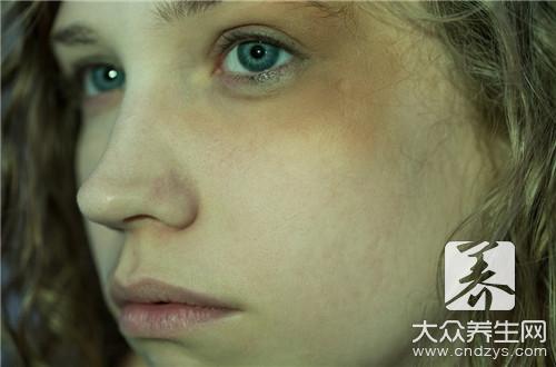 吃什么治黑眼圈 吃什么治黑眼圈