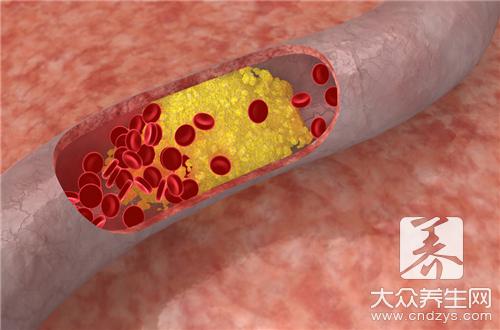 囊状淋巴管瘤的治疗方法 囊状淋巴管瘤的治疗方法