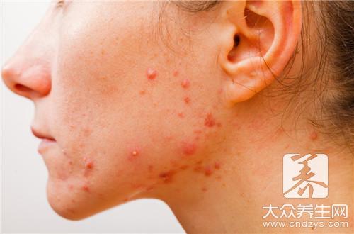 银杏果有哪些功效？