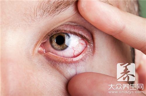 干燥综合症食疗，怎么吃才正确呢？