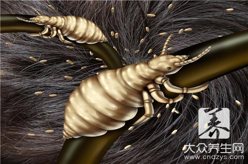 宝宝头发长虱子怎么办呢 宝宝头发长虱子怎么办呢