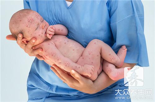 七类夫妻易生低能儿(1)