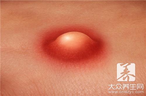 唾液腺堵塞的原因是什么