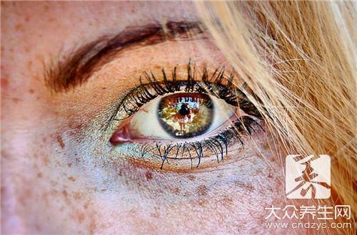 眼睛有黄斑是怎么回事