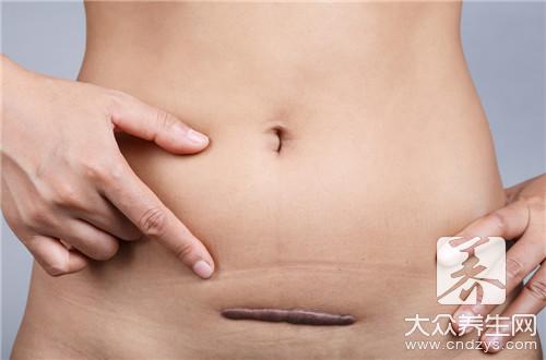 产后受风治疗应该怎么做？