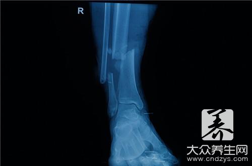 九大预兆 或许你已经患糖尿病了(6)