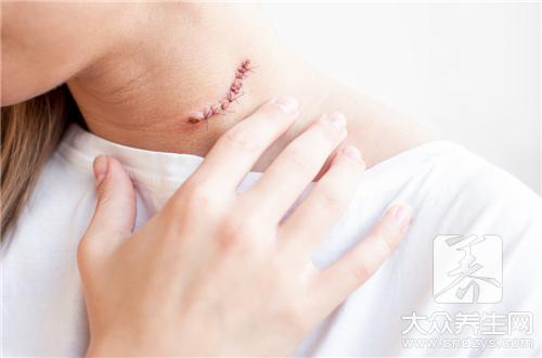 小孩颈部淋巴结肿大