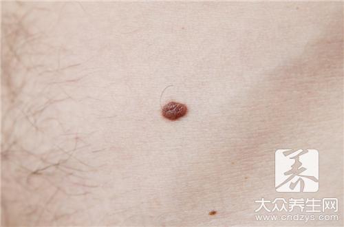 胳膊长毛怎么办呢