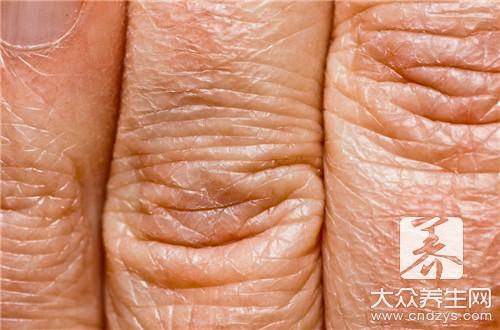 孕妈妈手脚冰冷怎么办？日常保养很重要(2)