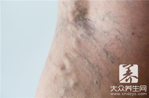 男人这地方湿湿的可能已癌变(3)