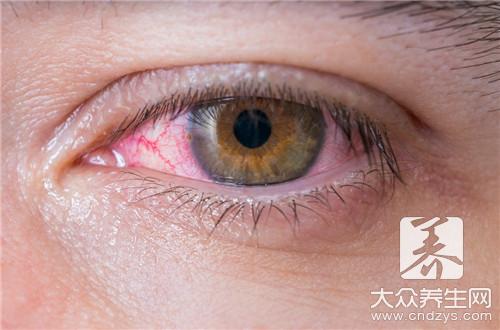 腿上有红血丝