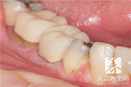 牙齿烟渍怎么去除效果好？