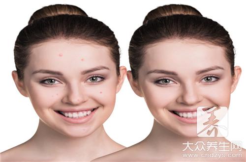 脸上出油毛孔粗大怎么办？怎么护理