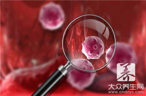 甲状腺瘤症状