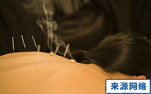 针灸减肥要注意什么 针灸减肥有哪些需要注意的 针灸减肥应该注意什么