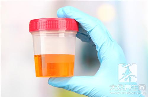  尿蛋白高怎么控制
