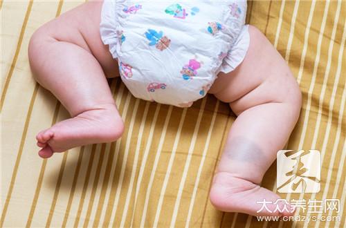 太田痣激光治疗有效吗