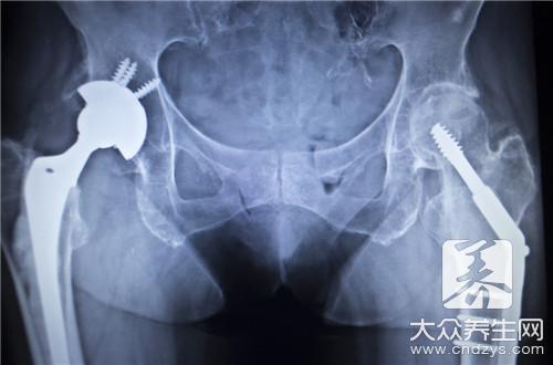 屁股骨头疼怎么回事