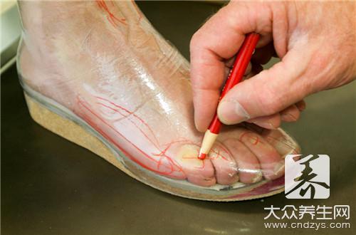 扁平苔癣的偏方
