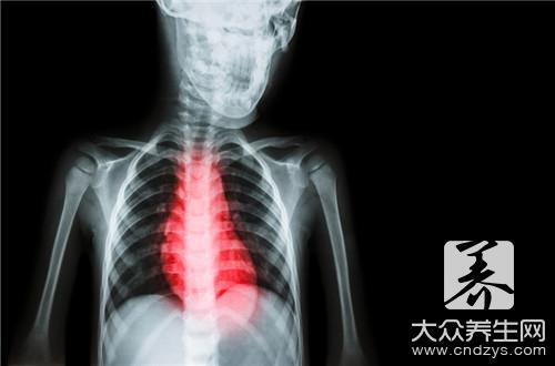 心肌病如何治疗？科学方法是这样！