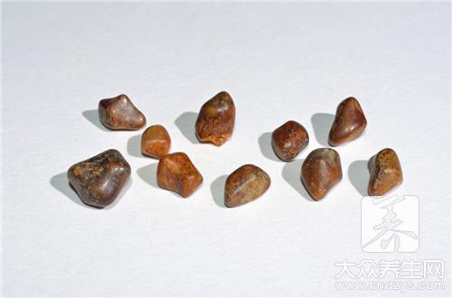 胆结石1厘米怎么办？