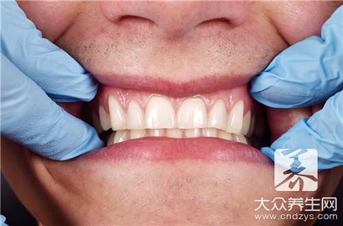 牙齿烟渍怎么去除效果好？