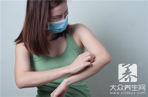 口服头孢后出现这些反应小心是过敏