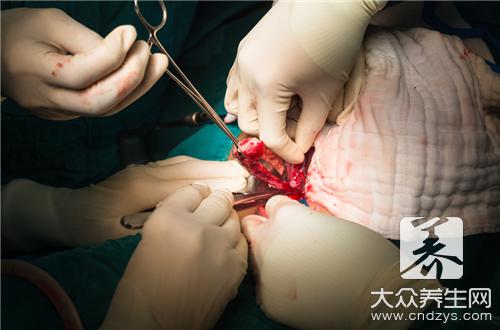 腹腔淋巴结肿怎么回事，易于哪些疾病混淆